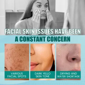 South Moon White Spot Cream Moisturizing Nourishing Spot Care Brightening Skincare Cream