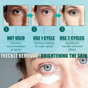 South Moon White Spot Cream Moisturizing Nourishing Spot Care Brightening Skincare Cream