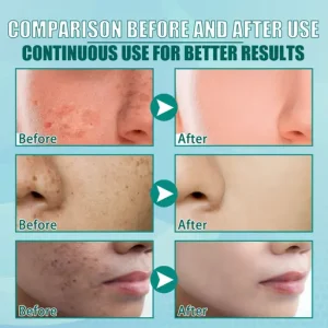 South Moon White Spot Cream Moisturizing Nourishing Spot Care Brightening Skincare Cream