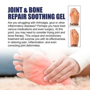 Knees Analgesic Roll-On Gel