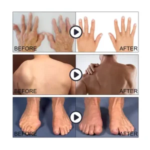 Knees Analgesic Roll-On Gel