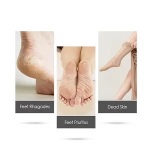 Rechargeable Electric Foot Grinder Callus Remover Dead Skin Scrubber