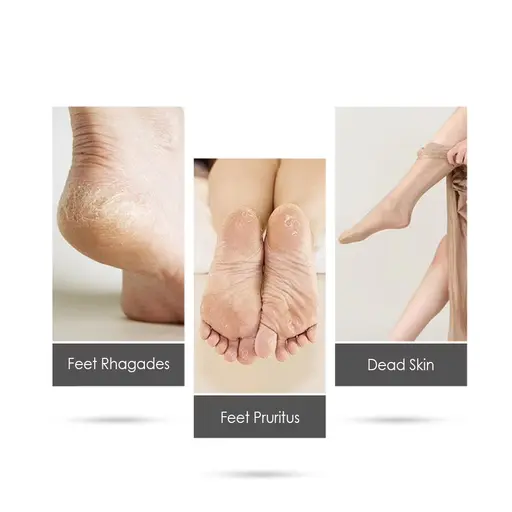Rechargeable Electric Foot Grinder Callus Remover Dead Skin Scrubber