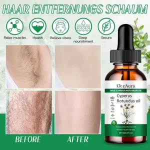 OceAura Cyperus Rotundus Oil Hair Removal Formula